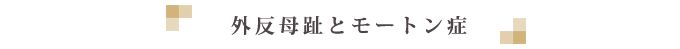 外反母趾とモートン症